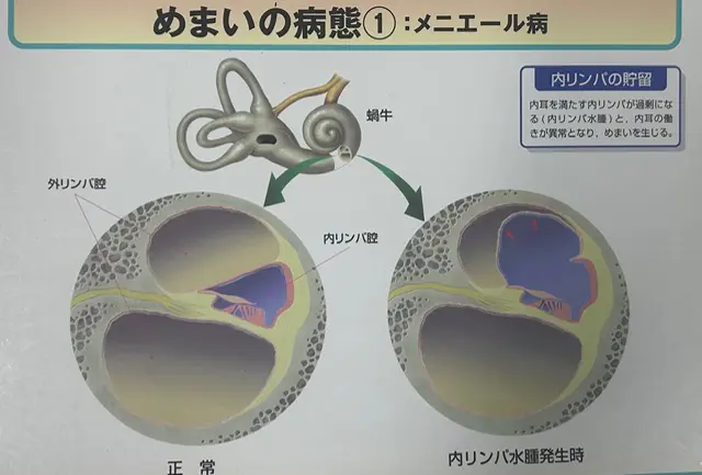 めまい | お茶の水頭痛めまいクリニック